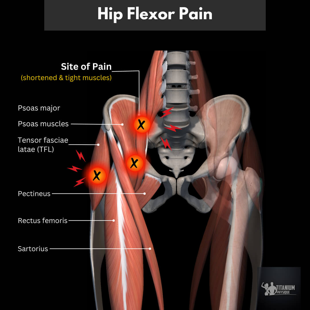 What Are The Hip Flexor Muscles What Are The Hip Flexor Muscles