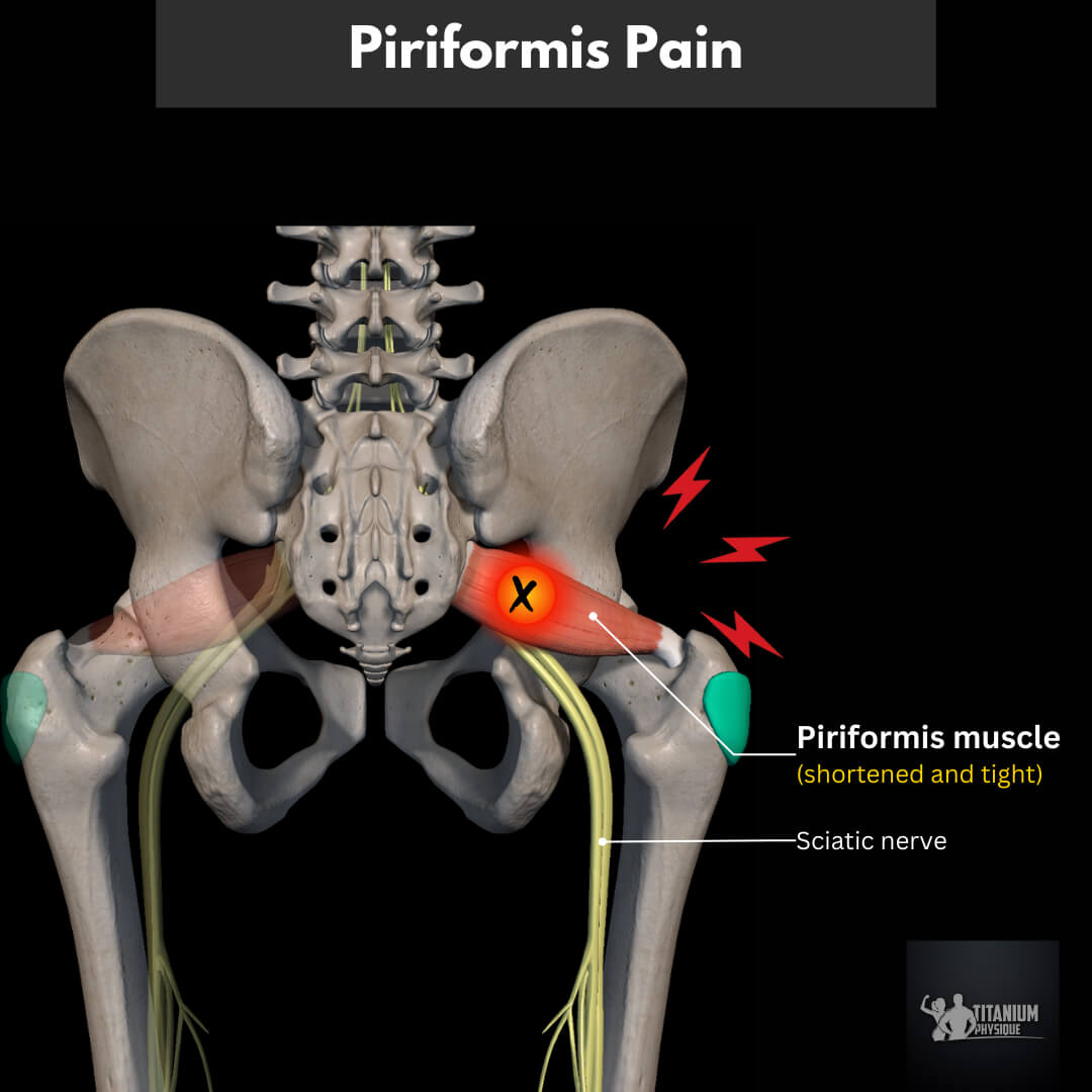 Hip Pain Root Causes And Relief Exercises