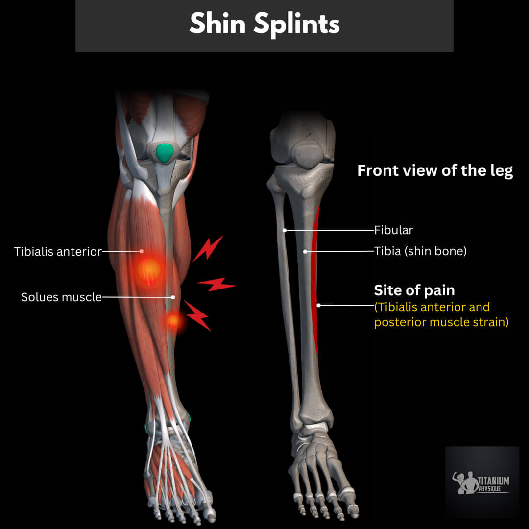 Leg Pain And Foot Tendonitis Root Causes Relief Exercise
